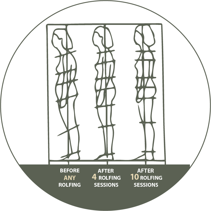 Rolfing Therapy Denver Best Rolfers for Nerve Pain Relief Back
